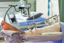 Robotic Joint Replacement Surgery: Is It Better Than Traditional Knee/Hip Replacement?